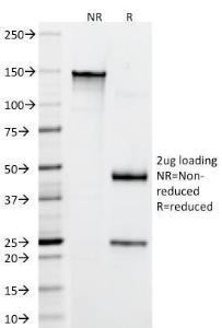 SDS-PAGE analysis of Anti-CD22 Antibody [FR10B4] under non-reduced and reduced conditions; showing intact IgG and intact heavy and light chains, respectively. SDS-PAGE analysis confirms the integrity and purity of the antibody