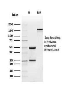 SDS-PAGE analysis of Anti-BMP15 Antibody [BMP15/4263] under non-reduced and reduced conditions; showing intact IgG and intact heavy and light chains, respectively SDS-PAGE analysis confirms the integrity and purity of the antibody