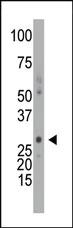 Anti-FXYD1 Mouse Monoclonal Antibody