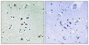 Immunohistochemical analysis of paraffin-embedded human brain using Anti-CDK1 (phospho Thr161) Antibody 1:100 (4°C overnight). The right hand panel represents a negative control, where the antibody was pre-incubated with the immunising peptide.