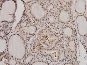 Anti-RCC1 Mouse Monoclonal Antibody [clone: 2F1]