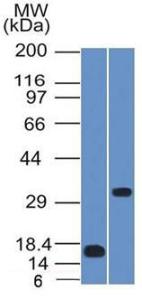 Western blot analysis of recombinant SOX2 protein fragment and NCCIT cell lysate using Anti-SOX2 Antibody [SOX2/1791]