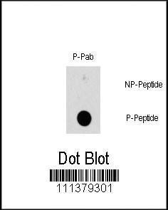 Anti-HSPB1 Rabbit Polyclonal Antibody (PE (Phycoerythrin))