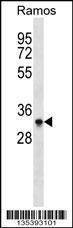 Anti-AURKB Rabbit Polyclonal Antibody (APC (Allophycocyanin))