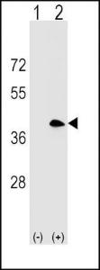 Anti-MS4A1 Rabbit Polyclonal Antibody (APC (Allophycocyanin))