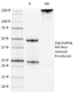 SDS-PAGE analysis of Anti-CD22 Antibody [MYG13] under non-reduced and reduced conditions; showing intact IgG and intact heavy and light chains, respectively. SDS-PAGE analysis confirms the integrity and purity of the Antibody