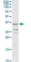 Anti-AKR7A2 Rabbit Polyclonal Antibody