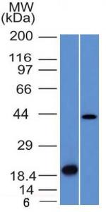 Western blot analysis of (A) recombinant Auora B protein and (B) human liver lysate using Anti-Aurora B Antibody [AURKB/1521]