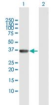 Anti-AKR7A2 Rabbit Polyclonal Antibody