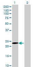 Anti-FAM89B Mouse Polyclonal Antibody