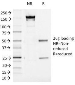 SDS-PAGE analysis of Anti-Aurora B Antibody [AURKB/1521] under non-reduced and reduced conditions; showing intact IgG and intact heavy and light chains, respectively. SDS-PAGE analysis confirms the integrity and purity of the Antibody