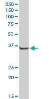 Anti-AKR7A2 Rabbit Polyclonal Antibody