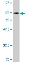 Anti-STK24 Mouse Monoclonal Antibody [clone: 1E12]