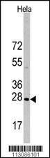 Anti-HSPB1 Rabbit Polyclonal Antibody (FITC (Fluorescein))