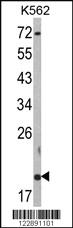 Anti-RNF5 Rabbit Polyclonal Antibody