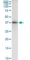 Anti-AKR7A2 Rabbit Polyclonal Antibody