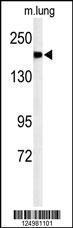 Anti-A2ML1 Rabbit Polyclonal Antibody (FITC (Fluorescein Isothiocyanate))