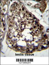 Anti-TBCEL Rabbit Polyclonal Antibody (FITC (Fluorescein Isothiocyanate))