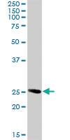 Anti-RAB32 Rabbit Polyclonal Antibody