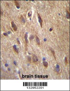 Anti-FGF11 Rabbit Polyclonal Antibody (HRP (Horseradish Peroxidase))