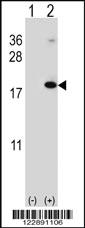 Anti-RNF5 Rabbit Polyclonal Antibody