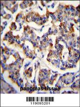 Anti-APCS Rabbit Polyclonal Antibody