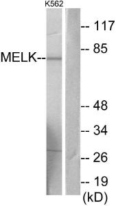 Western blot analysis of lysates from K562 cells using Anti-MELK Antibody. The right hand lane represents a negative control, where the antibody is blocked by the immunising peptide