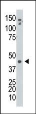 Anti-ADK Rabbit Polyclonal Antibody