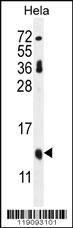 Anti-CDKN2A Rabbit Polyclonal Antibody