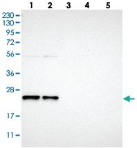 Anti-YIF1A Rabbit Polyclonal Antibody