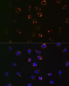 Immunofluorescence analysis of L929 cells using Anti-VDAC1/Porin Antibody [ARC0187] (A307081). DAPI was used to stain the cell nuclei (blue)