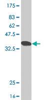 Anti-INPP5K Mouse Polyclonal Antibody