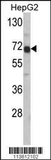 Anti-Fetoprotein Rabbit Polyclonal Antibody (AP (Alkaline Phosphatase))