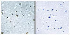 Immunohistochemical analysis of paraffin-embedded human brain using Anti-HMG17 (phospho Ser29) Antibody 1:100 (4°C overnight). The right hand panel represents a negative control, where the antibody was pre-incubated with the immunising peptide