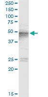 Anti-TSG101 Polyclonal Antibody Pair