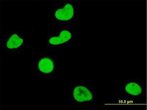 Anti-SGK1 Mouse Monoclonal Antibody [clone: 3E3]