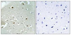 Immunohistochemical analysis of paraffin-embedded human brain using Anti-HAND1 (phospho Ser98) Antibody 1:100 (4 °C overnight). The right hand panel represents a negative control, where the antibody was pre-incubated with the immunising peptide