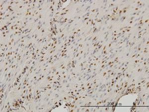 Anti-STAG1 Mouse Monoclonal Antibody [clone: 2E9]