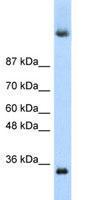 Anti-DAZ4 Rabbit Polyclonal Antibody