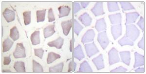 Immunohistochemical analysis of paraffin-embedded human skeletal muscle using Anti-CRYAB (phospho Ser59) Antibody. The right hand panel represents a negative control, where the antibody was pre-incubated with the immunising peptide