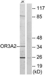 Western blot analysis of lysates from Jurkat cells using Anti-OR3A2 Antibody The right hand lane represents a negative control, where the antibody is blocked by the immunising peptide