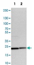 Anti-YIF1A Rabbit Polyclonal Antibody