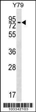 Anti-MAK Rabbit Polyclonal Antibody (HRP (Horseradish Peroxidase))