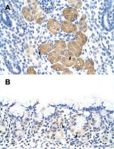 Anti-DAZ4 Rabbit Polyclonal Antibody