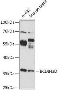 Western blot analysis of extracts of various cell lines, using Anti-BCDIN3D Antibody (A307084) at 1:1000 dilution