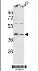 Anti-PGK1 Rabbit Polyclonal Antibody