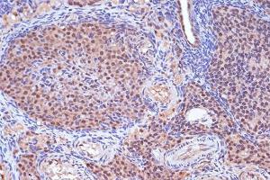 Immunohistochemistry analysis of paraffin-embedded rat ovary using Anti-MSH2 Antibody [ARC1285] (A307085) at a dilution of 1:100 (40x lens) Perform microwave antigen retrieval with 10 mM Tris/EDTA buffer pH 90 before commencing with IHC staining protocol