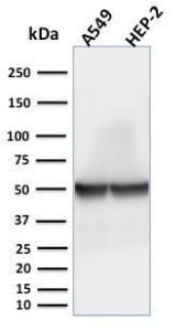 Western blot analysis of A549 and HEP-2 cell lysates using Anti-Cytokeratin 18 Antibody [rKRT18/1190]