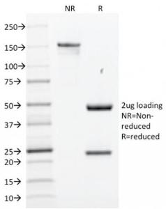 SDS-PAGE analysis of Anti-SOX2 Antibody [SOX2/1791] under non-reduced and reduced conditions; showing intact IgG and intact heavy and light chains, respectively. SDS-PAGE analysis confirms the integrity and purity of the antibody