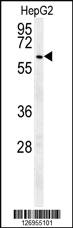 Anti-USP17L2 Rabbit Polyclonal Antibody